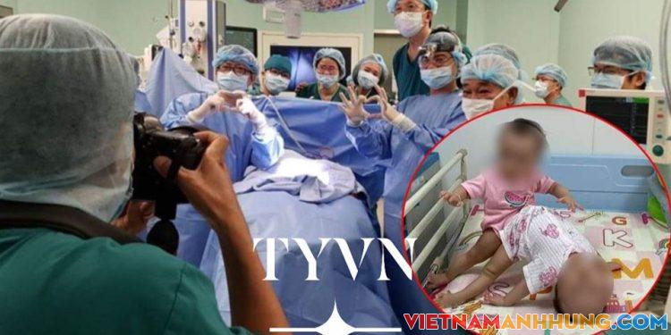 Nóng: Đã phẩu thuật tách cặp song sinh dính liền nhau thành công