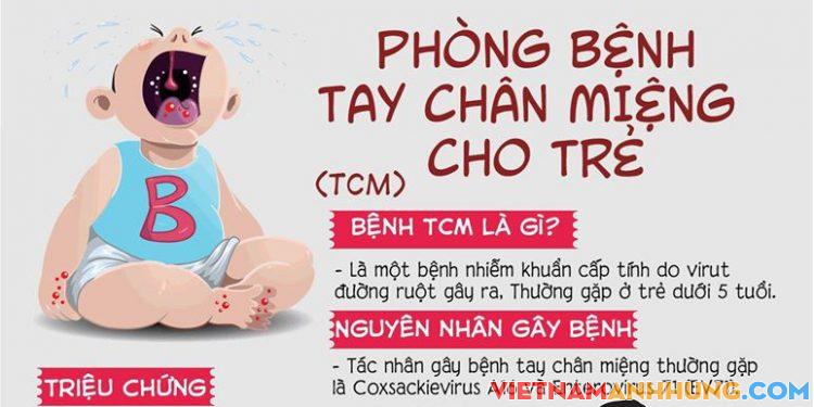 Chủ động phòng, chống bệnh tay chân miệng