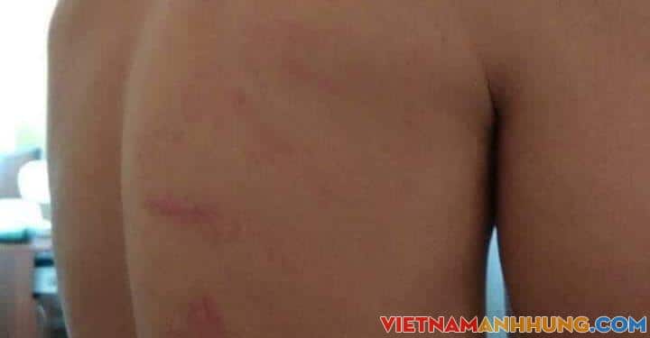 Đằng sau chiến thắng