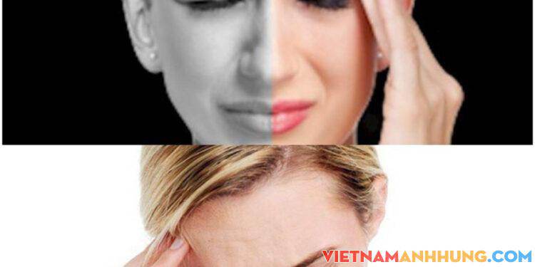 Giảm đau nửa đầu bằng đồ uống