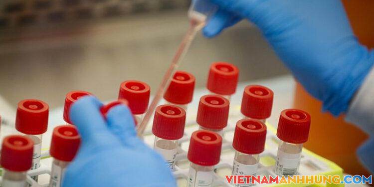 Yêu cầu kiểm soát về giá dịch vụ xét nghiệm, chẩn đoán Covid-19