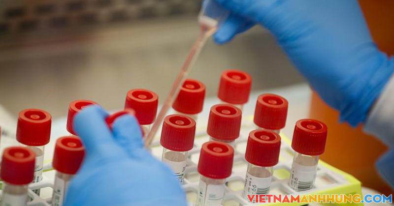 Yêu cầu kiểm soát về giá dịch vụ xét nghiệm, chẩn đoán Covid-19