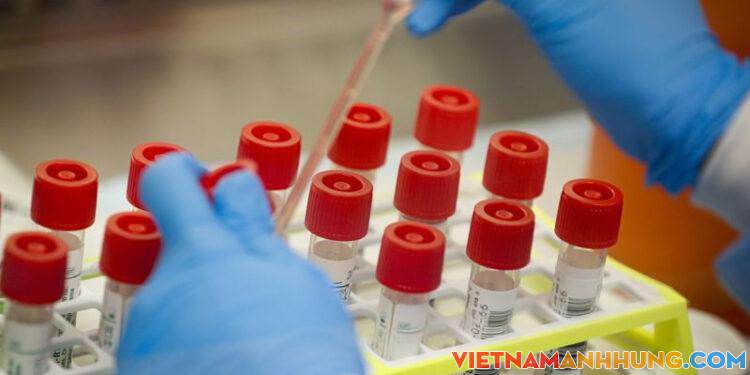 Không thực hiện mức giá dịch vụ theo yêu cầu với xét nghiệm Covid-19 tại cơ sở y tế công