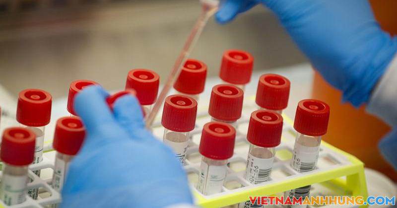 Không thực hiện mức giá dịch vụ theo yêu cầu với xét nghiệm Covid-19 tại cơ sở y tế công