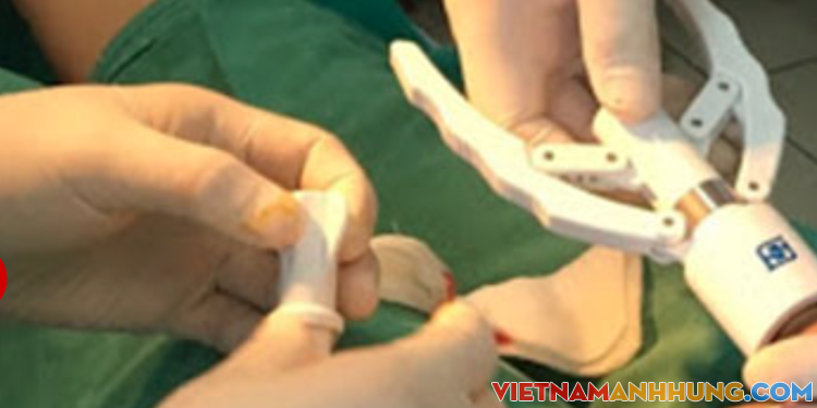 Mua máy trên mạng, tự cắt bao quy đầu thiếu niên nhập viện