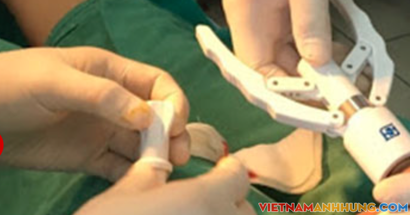 Mua máy trên mạng, tự cắt bao quy đầu thiếu niên nhập viện