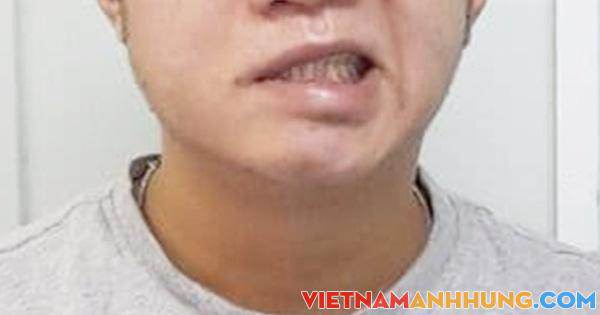 Trời đang trở lạnh, ngủ dậy bị méo miệng do thói quen này
